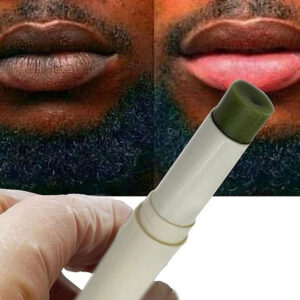 Lip Bleaching Cream